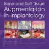 Bone and Soft Tissue Augmentation in Implantology (PDF)