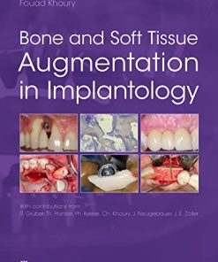 Bone and Soft Tissue Augmentation in Implantology (PDF)