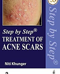 Step by Step Treatment of Acne Scars, 2nd Edition (PDF)