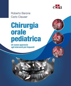 Chirurgia orale pediatrica: Un nuovo approccio agli interventi più frequenti (Italian Edition) (EPUB)