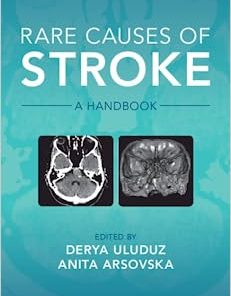 Rare Causes of Stroke: A Handbook (PDF)