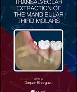 Transalveolar Extraction of the Mandibular Third Molars (PDF)