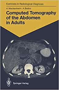 Computed Tomography of the Abdomen in Adults: 85 Radiological Exercises for Students and Practitioners (Exercises in Radiological Diagnosis) (PDF)