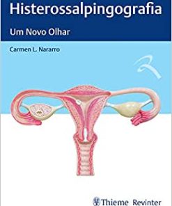 Histerossalpingografia: Um Novo Olhar (PDF)