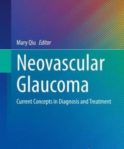 Neovascular Glaucoma: Current Concepts in Diagnosis and Treatment (Essentials in Ophthalmology) (EPUB)