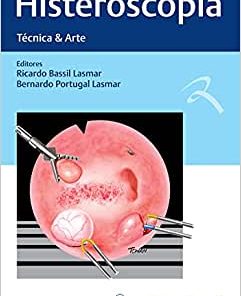 Histeroscopia: Técnica & Arte (PDF)