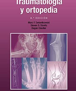 Manual de traumatología y ortopedia, 8th Edition (Spanish Edition) (High Quality Image PDF)