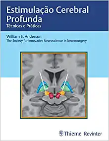 Estimulação Cerebral Profunda: Técnicas e Práticas (PDF)