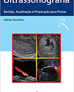 Ultrassonografia: Revisão, Atualização e Preparação para Provas (EPUB)