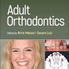 Adult Orthodontics, 2nd Edition (PDF)