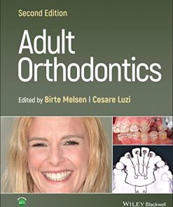 Adult Orthodontics, 2nd Edition (PDF)