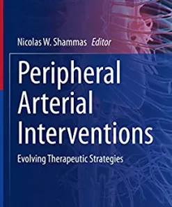 Peripheral Arterial Interventions: Evolving Therapeutic Strategies (Contemporary Cardiology) (EPUB)