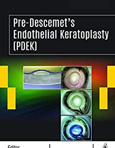 Pre-Descemet’s Endothelial Keratoplasty (PDEK) (PDF Book+Videos)