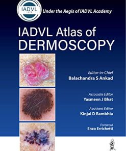 IADVL Atlas of Dermoscopy (PDF)