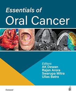 Essentials of Oral Cancer (PDF)