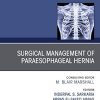 Paraesophageal Hernia Repair,An Issue of Thoracic Surgery Clinics (Volume 29-4) (The Clinics: Surgery, Volume 29-4) (PDF)