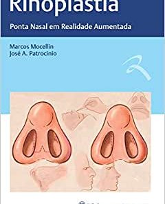 Rinoplastia: Ponta Nasal em Realidade Aumentada (PDF)