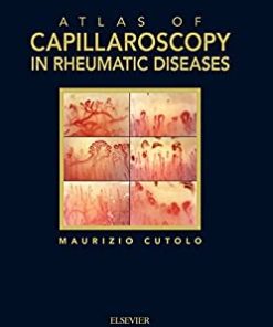 Atlas of capillaroscopy in rheumatic diseases (PDF)