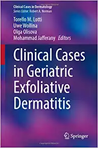 Clinical Cases in Geriatric Exfoliative Dermatitis (Clinical Cases in Dermatology) (PDF)