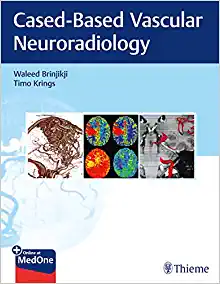 Imaging in Neurovascular Disease: A Case-Based Approach (EPUB)