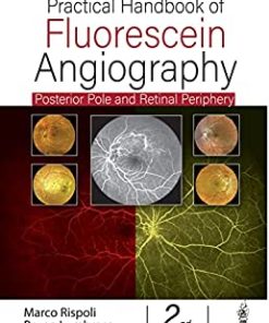 Practical Handbook of Fluorescein Angiography: Posterior Pole and Retinal Periphery, 2nd Edition (PDF)