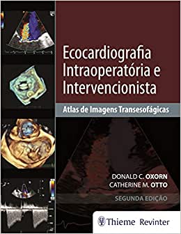 Ecocardiografia Intraoperatória e Intervencionista: Atlas de Imagens Tansesofágicas, 2nd Edition (PDF) Ecocardiografia Intraoperatória e Intervencionista: Atlas de Imagens Tansesofágicas, 2nd Edition (PDF)