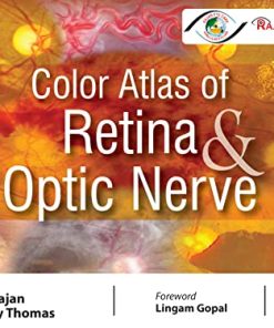 Color Atlas of Retina and Optic Nerve (PDF)