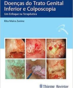 Doenças do Trato Genital Inferior e Colposcopia: Um Enfoque na Terapêutica (PDF)