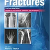 Handbook of fractures (First South Asia Edition) (PDF)