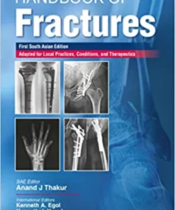 Handbook of fractures (First South Asia Edition) (PDF)