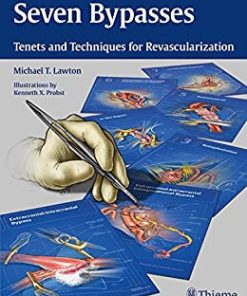 Seven Bypasses: Tenets and Techniques for Revascularization (EPUB)