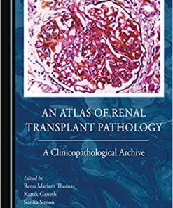 An Atlas of Renal Transplant Pathology (PDF)