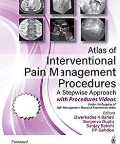 Atlas of Interventional Pain Management Procedures: A Stepwise Approach (PDF)