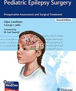 Pediatric Epilepsy Surgery: Preoperative Assessment and Surgical Treatment, 2nd Edition (EPUB)