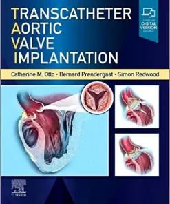 Transcatheter Aortic Valve Implantation (PDF)