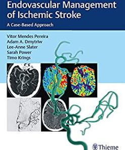 Endovascular Management of Ischemic Stroke: A Case-Based Approach (EPUB)