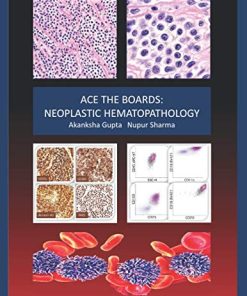 Ace the Boards: Neoplastic Hematopathology (Ace My Path) (PDF)