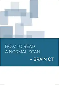 How to Read a Normal Scan : Brain CT (High Quality Image PDF)