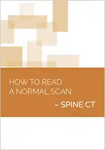 How to Read a Normal Scan : SPINE CT (High Quality Image PDF)