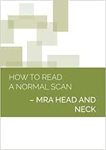 How to Read a Normal Scan: MRA HEAD AND NECK (High Quality Image PDF)