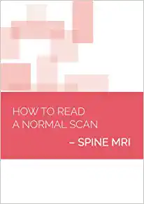 How to read a Normal Scan: Spine MRI (High Quality Image PDF)