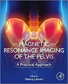 Magnetic Resonance Imaging of The Pelvis: A Practical Approach (PDF)