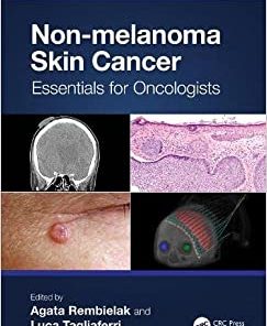 Non-melanoma Skin Cancer: Essentials for Oncologists (PDF)