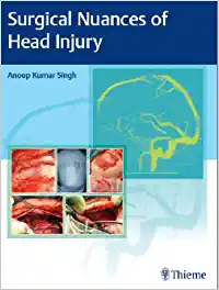 Surgical Nuances of Head Injury (PDF)