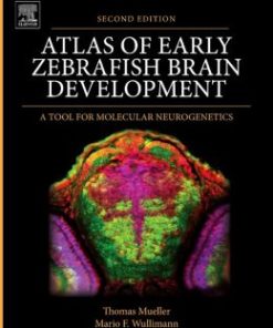 Atlas of Early Zebrafish Brain Development: A Tool for Molecular Neurogenetics