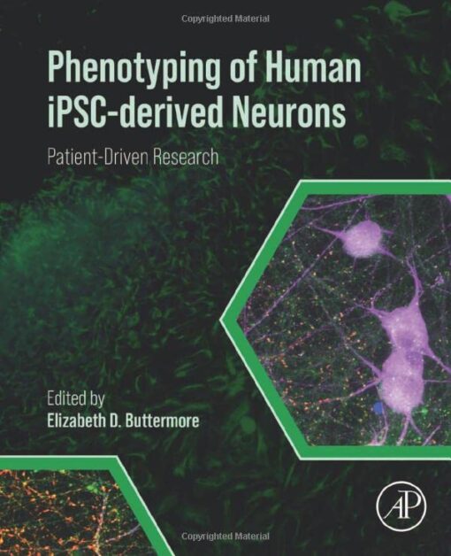 Phenotyping of Human iPSC-derived Neurons: Patient-Driven Research (EPUB) Phenotyping of Human iPSC-derived Neurons: Patient-Driven Research (EPUB)