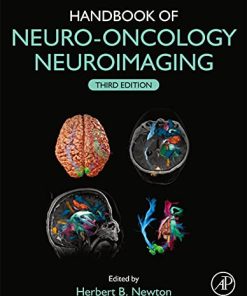 Handbook of Neuro-Oncology Neuroimaging, 3rd Edition (PDF)