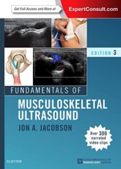 Fundamentals of Musculoskeletal Ultrasound, 3rd Edition (Fundamentals of Radiology) (PDF)