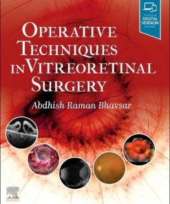 Operative Techniques in Vitreoretinal Surgery (PDF)