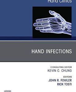 Hand Infections, An Issue of Hand Clinics (Volume 36-3) (The Clinics: Orthopedics, Volume 36-3) (PDF)